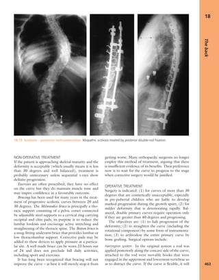 Apley's shoulderjt examination