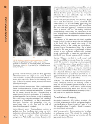 Apley's shoulderjt examination