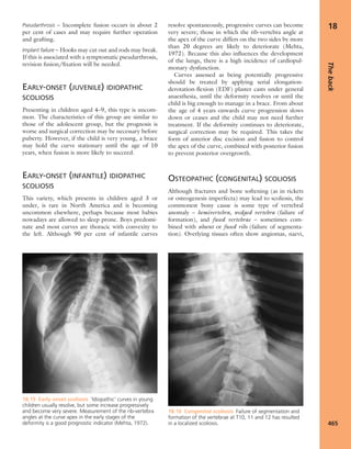 Apley's shoulderjt examination