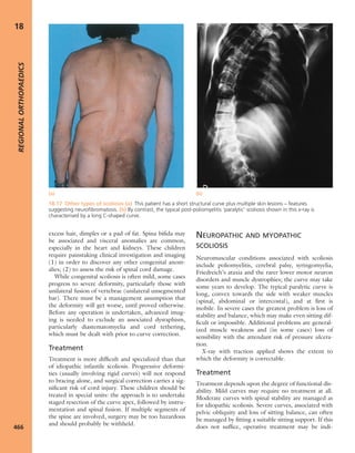 Apley's shoulderjt examination