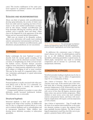 Apley's shoulderjt examination