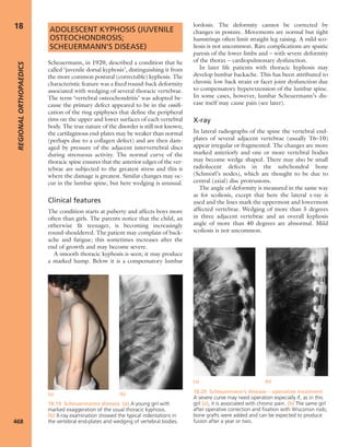 Apley's shoulderjt examination