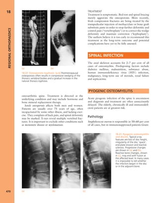 Apley's shoulderjt examination