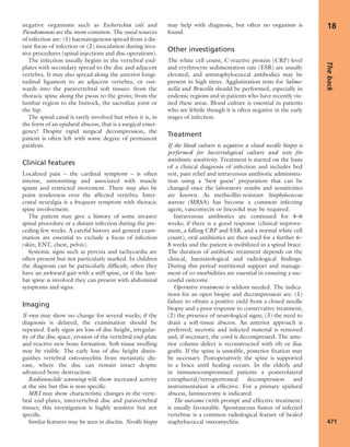 Apley's shoulderjt examination