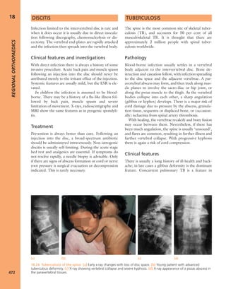 Apley's shoulderjt examination