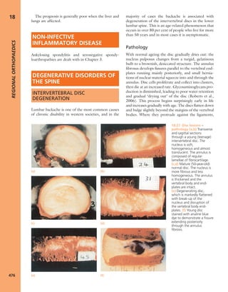 Apley's shoulderjt examination