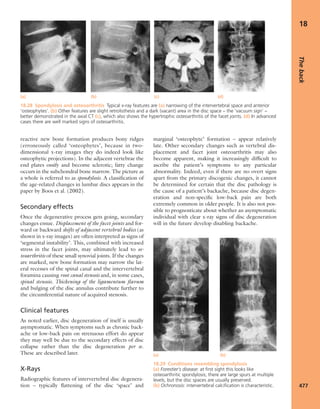 Apley's shoulderjt examination