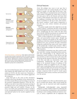 Apley's shoulderjt examination