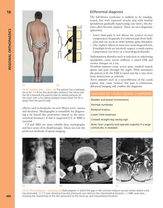 Apley's shoulderjt examination
