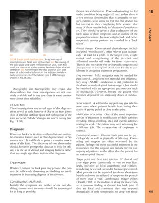Apley's shoulderjt examination