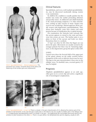 Apley's shoulderjt examination