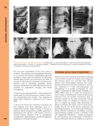 Apley's shoulderjt examination