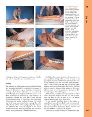 Apley's shoulderjt examination