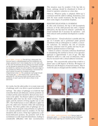 Apley's shoulderjt examination