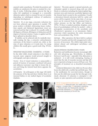 Apley's shoulderjt examination