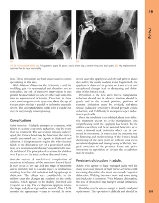 Apley's shoulderjt examination