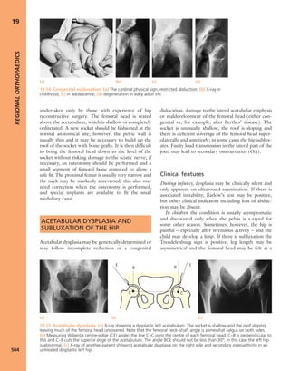 Apley's shoulderjt examination