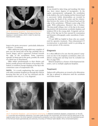 Apley's shoulderjt examination