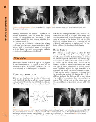 Apley's shoulderjt examination