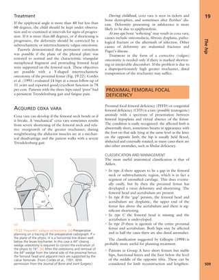 Apley's shoulderjt examination