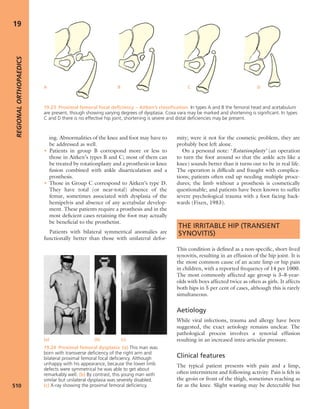 Apley's shoulderjt examination