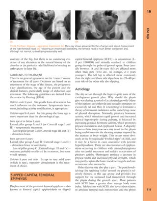 Apley's shoulderjt examination