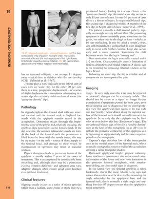 Apley's shoulderjt examination