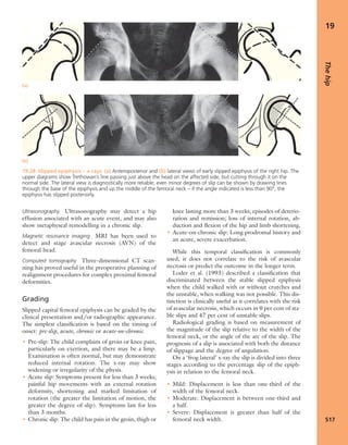 Apley's shoulderjt examination