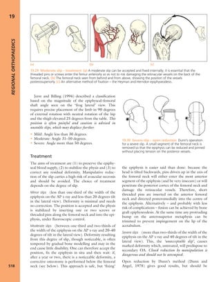Apley's shoulderjt examination