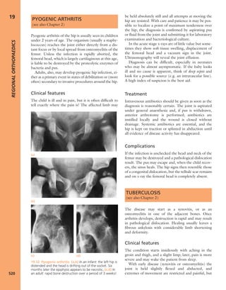 Apley's shoulderjt examination