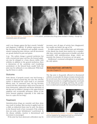 Apley's shoulderjt examination