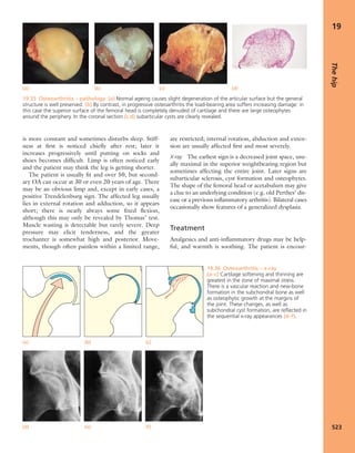 Apley's shoulderjt examination