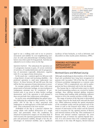 Apley's shoulderjt examination