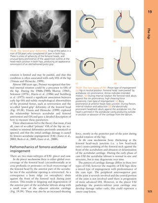 Apley's shoulderjt examination