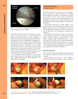 Apley's shoulderjt examination