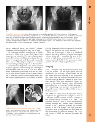Apley's shoulderjt examination
