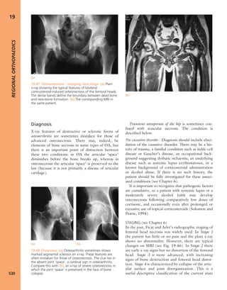 Apley's shoulderjt examination