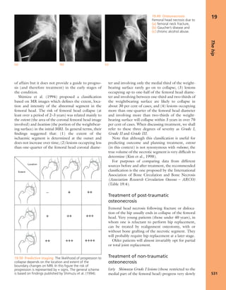 Apley's shoulderjt examination