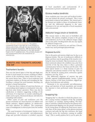 Apley's shoulderjt examination