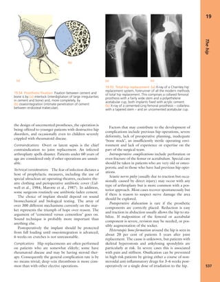 Apley's shoulderjt examination