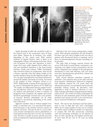 Apley's shoulderjt examination