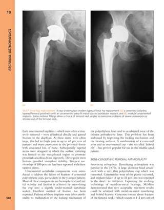 Apley's shoulderjt examination