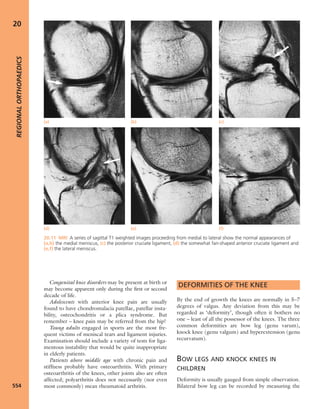 Apley's shoulderjt examination