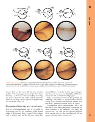 Apley's shoulderjt examination