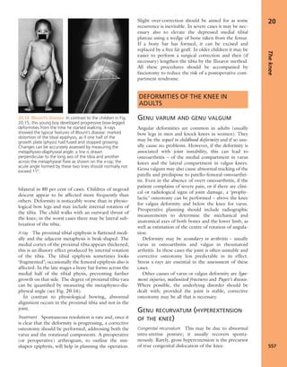 Apley's shoulderjt examination