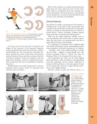 Apley's shoulderjt examination