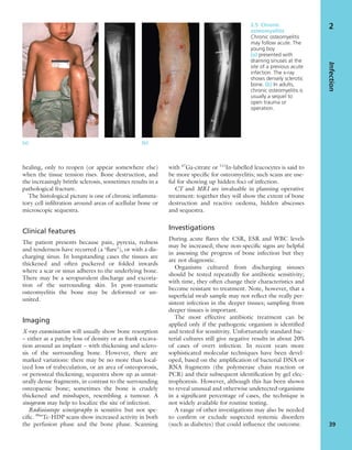 healing, only to reopen (or appear somewhere else)
when the tissue tension rises. Bone destruction, and
the increasingly brittle sclerosis, sometimes results in a
pathological fracture.
The histological picture is one of chronic inﬂamma-
tory cell inﬁltration around areas of acellular bone or
microscopic sequestra.
Clinical features
The patient presents because pain, pyrexia, redness
and tenderness have recurred (a ‘ﬂare’), or with a dis-
charging sinus. In longstanding cases the tissues are
thickened and often puckered or folded inwards
where a scar or sinus adheres to the underlying bone.
There may be a seropurulent discharge and excoria-
tion of the surrounding skin. In post-traumatic
osteomyelitis the bone may be deformed or un-
united.
Imaging
X-ray examination will usually show bone resorption
– either as a patchy loss of density or as frank excava-
tion around an implant – with thickening and sclero-
sis of the surrounding bone. However, there are
marked variations: there may be no more than local-
ized loss of trabeculation, or an area of osteoporosis,
or periosteal thickening; sequestra show up as unnat-
urally dense fragments, in contrast to the surrounding
osteopaenic bone; sometimes the bone is crudely
thickened and misshapen, resembling a tumour. A
sinogram may help to localize the site of infection.
Radioisotope scintigraphy is sensitive but not spe-
ciﬁc. 99m
Tc-HDP scans show increased activity in both
the perfusion phase and the bone phase. Scanning
with 67
Ga-citrate or 111
In-labelled leucocytes is said to
be more speciﬁc for osteomyelitis; such scans are use-
ful for showing up hidden foci of infection.
CT and MRI are invaluable in planning operative
treatment: together they will show the extent of bone
destruction and reactive oedema, hidden abscesses
and sequestra.
Investigations
During acute ﬂares the CSR, ESR and WBC levels
may be increased; these non-speciﬁc signs are helpful
in assessing the progress of bone infection but they
are not diagnostic.
Organisms cultured from discharging sinuses
should be tested repeatedly for antibiotic sensitivity;
with time, they often change their characteristics and
become resistant to treatment. Note, however, that a
superﬁcial swab sample may not reﬂect the really per-
sistent infection in the deeper tissues; sampling from
deeper tissues is important.
The most effective antibiotic treatment can be
applied only if the pathogenic organism is identiﬁed
and tested for sensitivity. Unfortunately standard bac-
terial cultures still give negative results in about 20%
of cases of overt infection. In recent years more
sophisticated molecular techniques have been devel-
oped, based on the ampliﬁcation of bacterial DNA or
RNA fragments (the polymerase chain reaction or
PCR) and their subsequent identiﬁcation by gel elec-
trophoresis. However, although this has been shown
to reveal unusual and otherwise undetected organisms
in a signiﬁcant percentage of cases, the technique is
not widely available for routine testing.
A range of other investigations may also be needed
to conﬁrm or exclude suspected systemic disorders
(such as diabetes) that could inﬂuence the outcome.
Infection
39
2
(a) (b)
2.5 Chronic
osteomyelitis
Chronic osteomyelitis
may follow acute. The
young boy
(a) presented with
draining sinuses at the
site of a previous acute
infection. The x-ray
shows densely sclerotic
bone. (b) In adults,
chronic osteomyelitis is
usually a sequel to
open trauma or
operation.
 