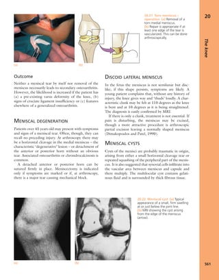 Apley's shoulderjt examination