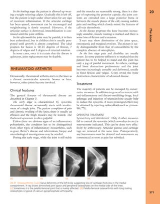 Apley's shoulderjt examination