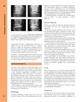 Apley's shoulderjt examination